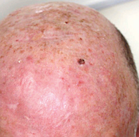 Fig 1a.